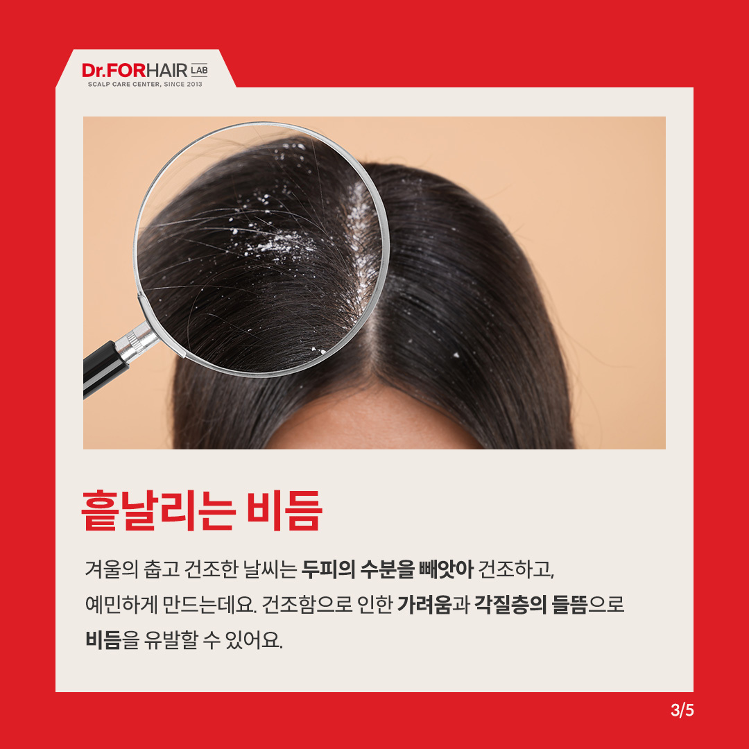 추운 겨울 건강한 두피 관리방법