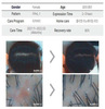 30대 여성 가르마탈모 리커버리케어