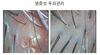 여성두피 염증성두피 3개월관리후기
