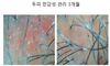 두피민감성 3개월 관리후기